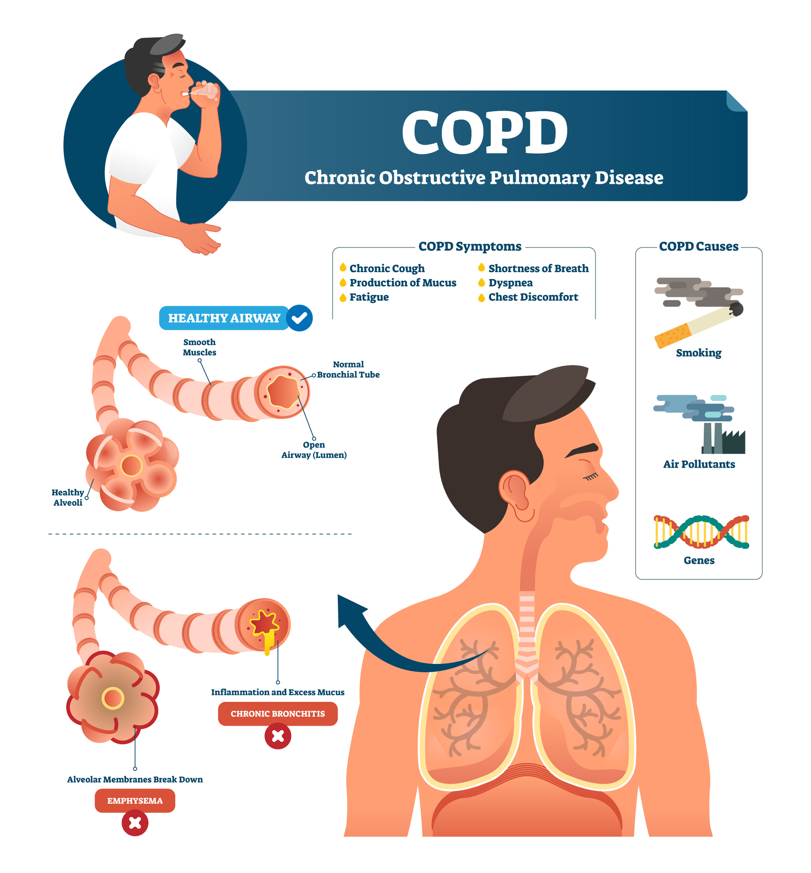 COPD symptoms and causes