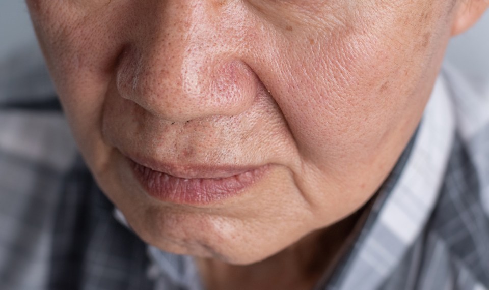 close up of face with parkinson's voice